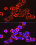 Immunofluorescence - UGT2B17 Rabbit pAb (A20683)