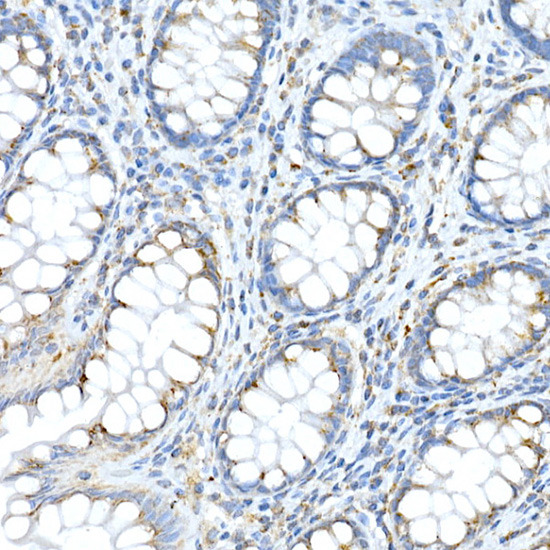 FAM3A Rabbit polyclonal antibody