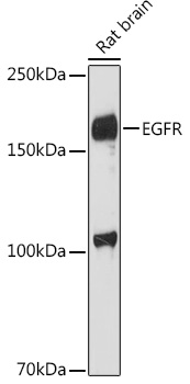EGFR Rabbit polyclonal antibody