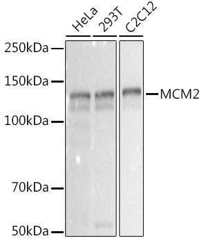 MCM2 Rabbit monoclonal antibody