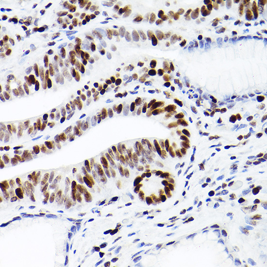 MCM2 Rabbit monoclonal antibody