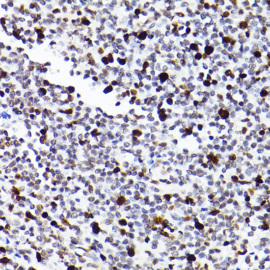MCM2 Rabbit monoclonal antibody