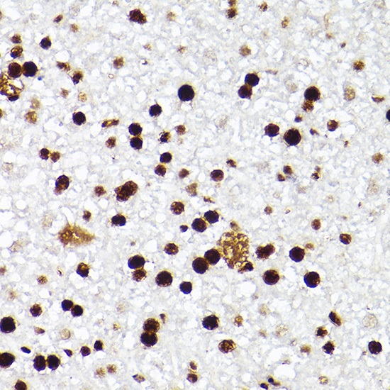 MCM2 Rabbit monoclonal antibody