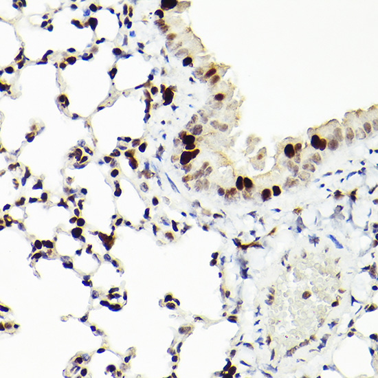 MCM2 Rabbit monoclonal antibody