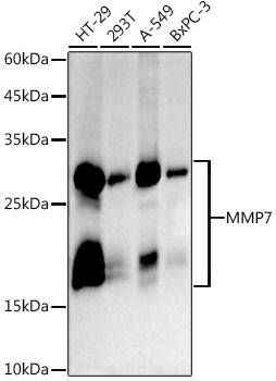 MMP7 Rabbit monoclonal antibody