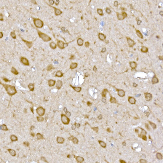 CASTOR1 Rabbit polyclonal antibody