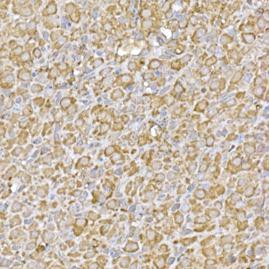CASTOR1 Rabbit polyclonal antibody