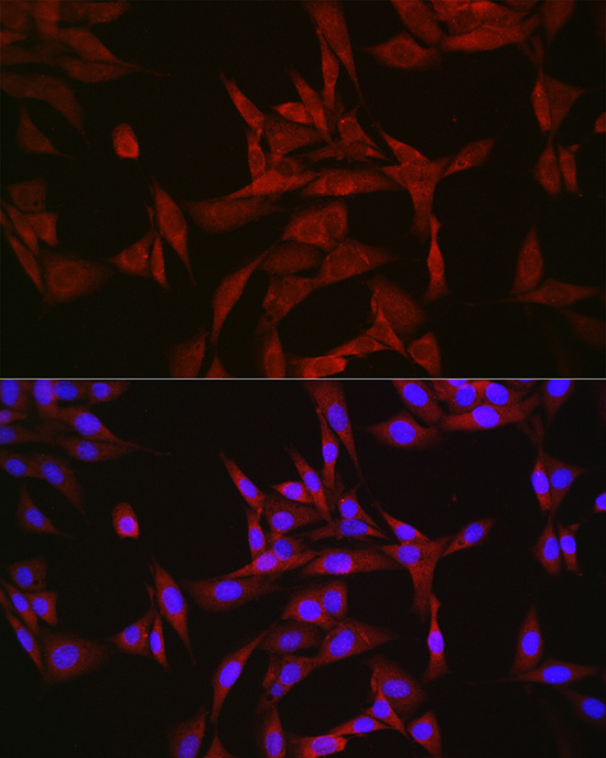 CASTOR1 Rabbit polyclonal antibody