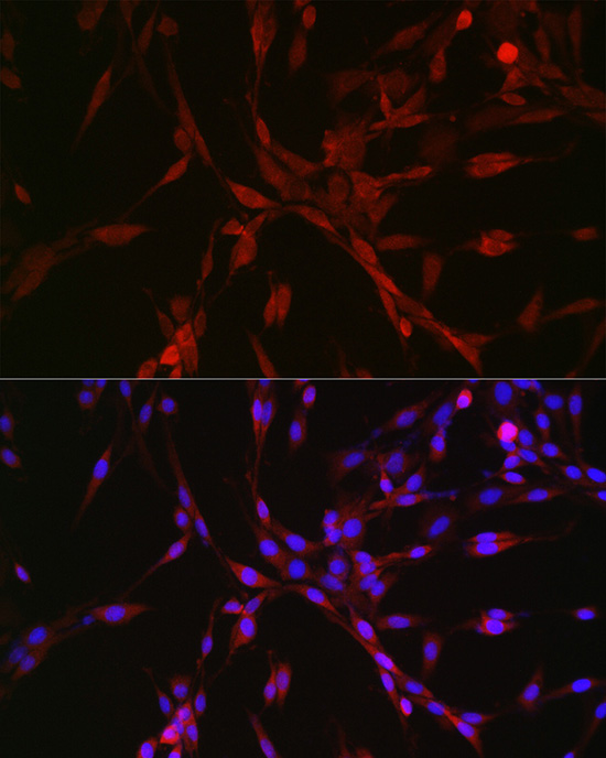CASTOR1 Rabbit polyclonal antibody