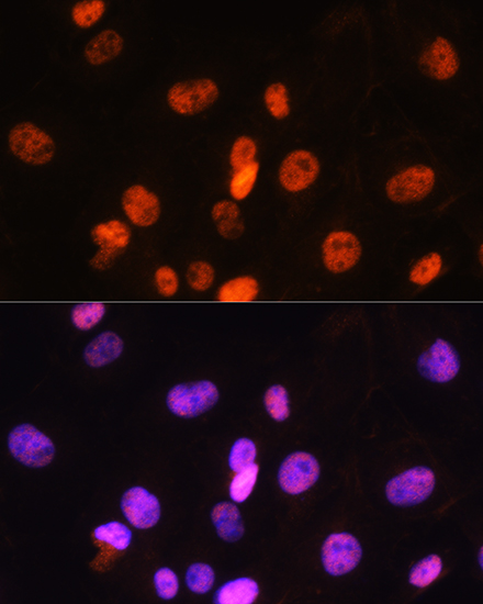 FANCD2 Rabbit polyclonal antibody