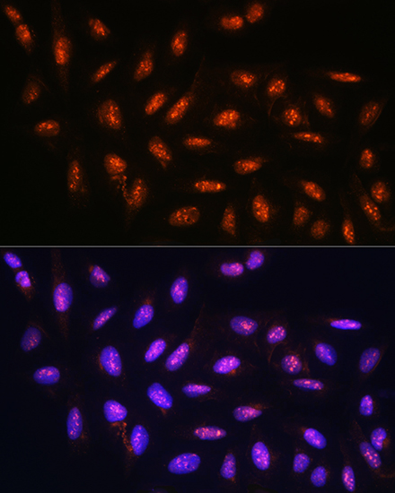 FANCD2 Rabbit polyclonal antibody
