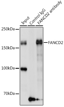 FANCD2 Rabbit polyclonal antibody