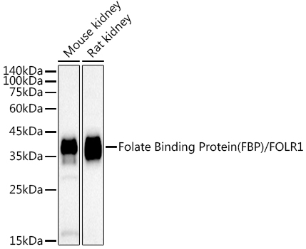 Folate Binding Protein(FBP) / FOLR1 Rabbit monoclonal antibody