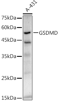 GSDMD (Full length+C terminal) Rabbit monoclonal antibody