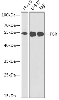 FGR Rabbit polyclonal antibody