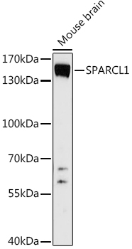 SPARCL1 Rabbit polyclonal antibody