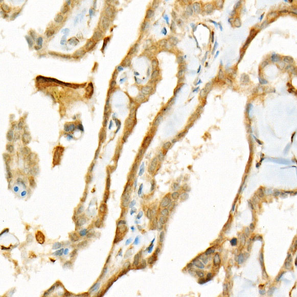 Bcl-2 Mouse monoclonal antibody