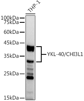 YKL-40/CHI3L1 Rabbit monoclonal antibody