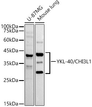 YKL-40/CHI3L1 Rabbit monoclonal antibody
