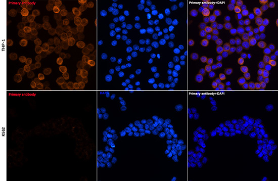 YKL-40/CHI3L1 Rabbit monoclonal antibody
