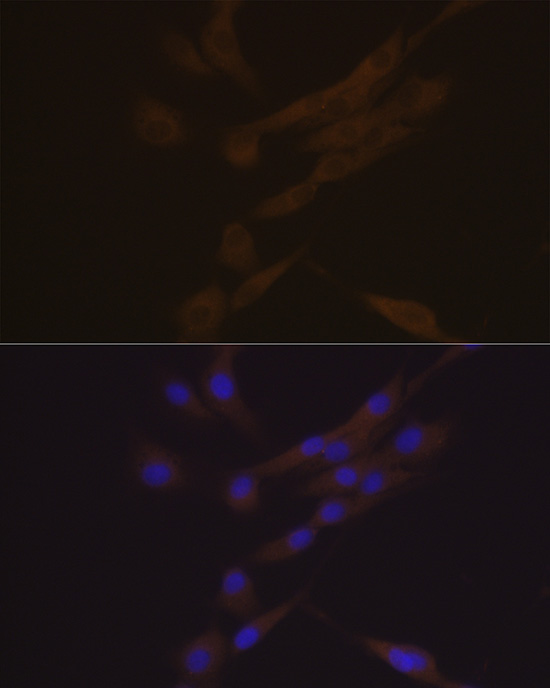 YKL-40/CHI3L1 Rabbit monoclonal antibody