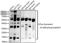Western blot - Pan-Symmetric Di-Methyl Arginine Motif Rabbit mAb (A20794)