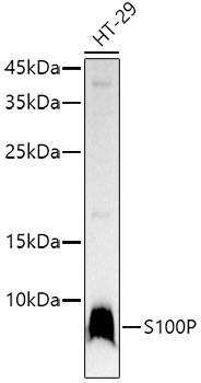 S100P Rabbit monoclonal antibody