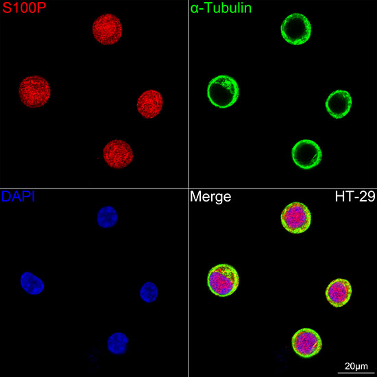 S100P Rabbit monoclonal antibody