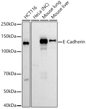 E-Cadherin Rabbit monoclonal antibody