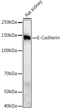 E-Cadherin Rabbit monoclonal antibody