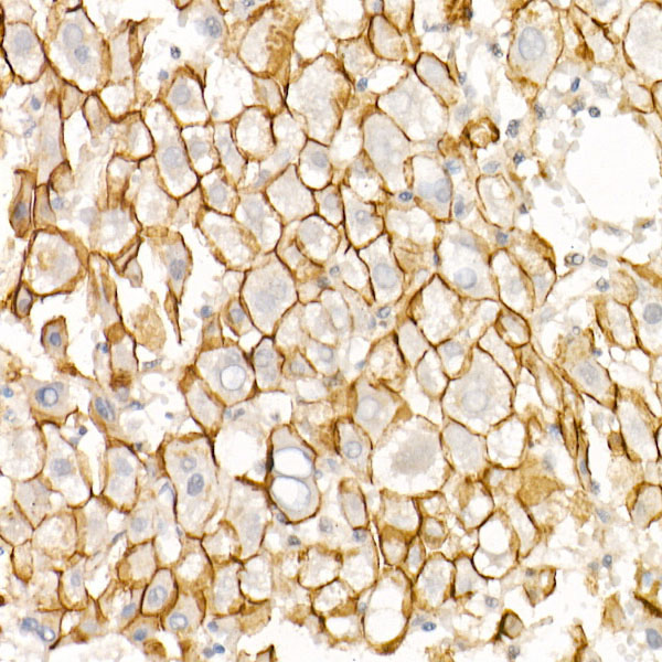 E-Cadherin Rabbit monoclonal antibody