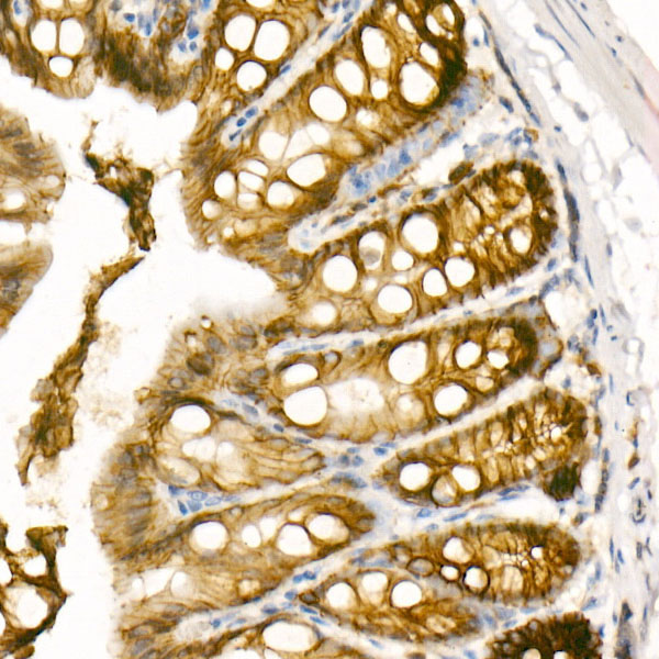 E-Cadherin Rabbit monoclonal antibody