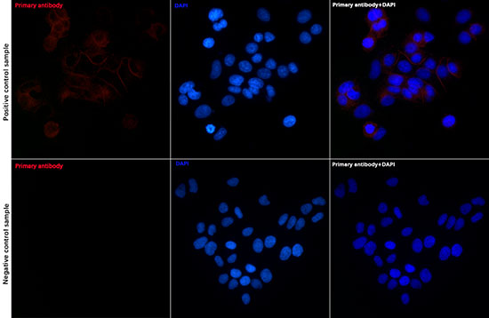 E-Cadherin Rabbit monoclonal antibody