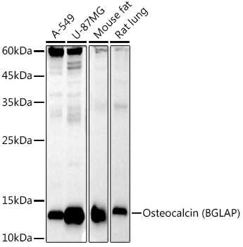 Osteocalcin (BGLAP) Rabbit monoclonal antibody