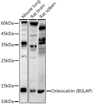 Osteocalcin (BGLAP) Rabbit monoclonal antibody