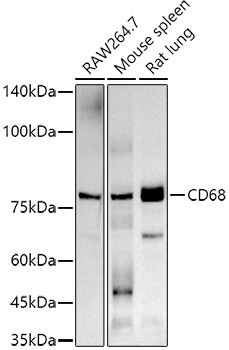 CD68 Rabbit monoclonal antibody