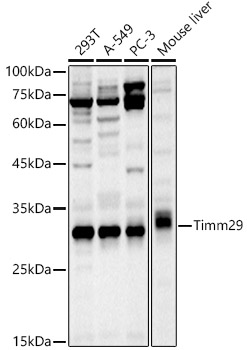 Timm29 Rabbit polyclonal antibody