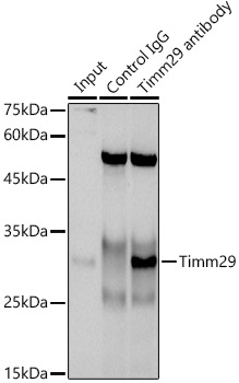 Timm29 Rabbit polyclonal antibody