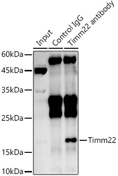 Timm22 Rabbit polyclonal antibody