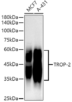 TROP-2 Rabbit monoclonal antibody