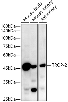 TROP-2 Rabbit monoclonal antibody