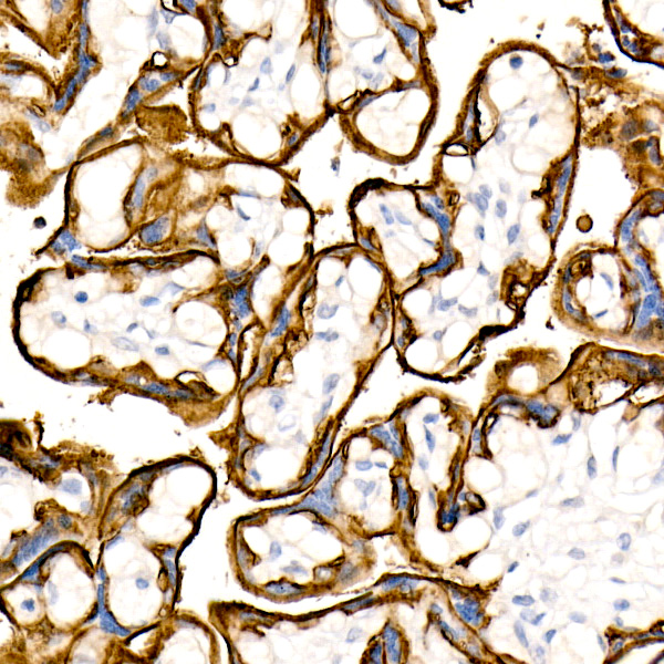 TROP-2 Rabbit monoclonal antibody