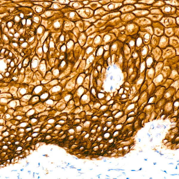 TROP-2 Rabbit monoclonal antibody