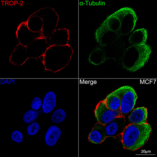 TROP-2 Rabbit monoclonal antibody
