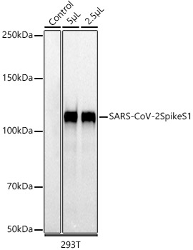 SARS-CoV-2 Spike S1 Rabbit mAb