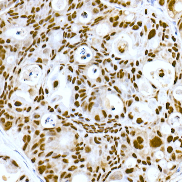 DNA-PKcs Rabbit monoclonal antibody