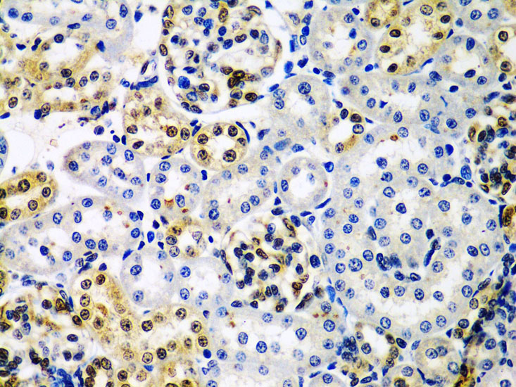 HDAC2 Rabbit polyclonal antibody
