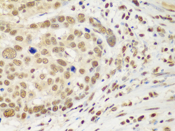 HDAC2 Rabbit polyclonal antibody