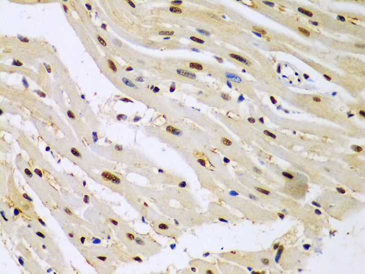 HDAC2 Rabbit polyclonal antibody