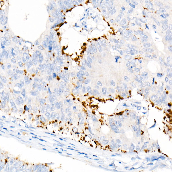 Perilipin-2 Rabbit monoclonal antibody
